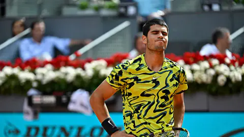 Tenis Dünyasında Şok: Carlos Alcaraz Wimbledon'dan Çekildi